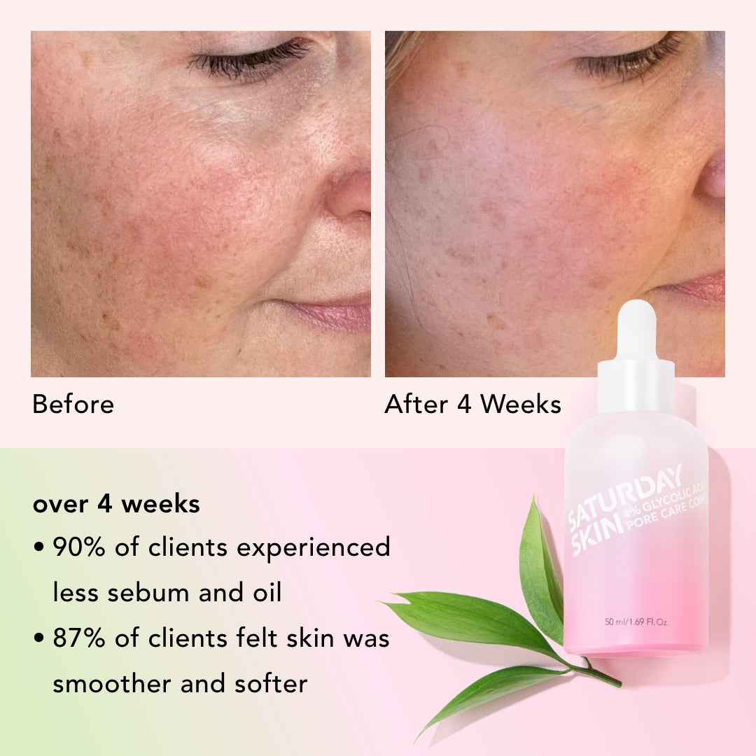 before and after of Pore Active Treatment product