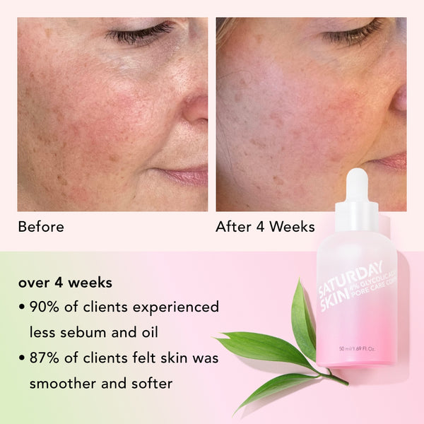 before and after of Pore Active Treatment product