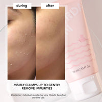 Saturday Skin Rub-A-Dub Refining Peel Gel, Dead Skin Remover with Gentle Formula