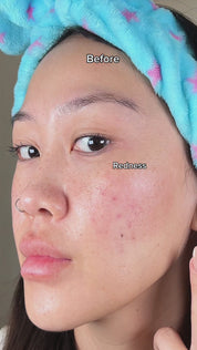 Yuzu Vitamin C Butterfly Hydrogel Mask